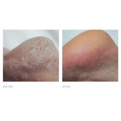 DD Cream Mousse Formula #1