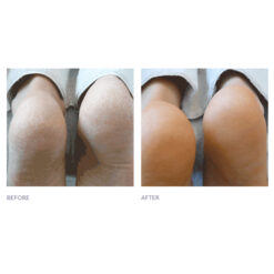 Very Dry Skin Formula #3