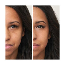 Enlighten Concealer™