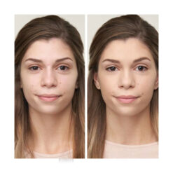 Disappear™ Full Coverage Concealer